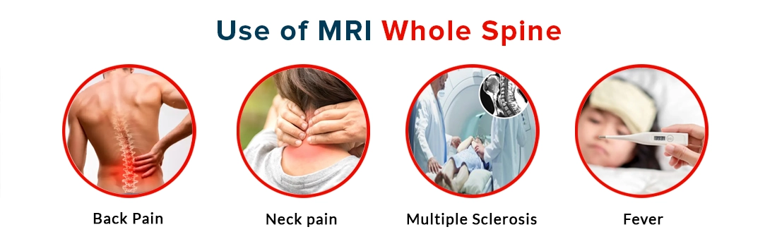Use of MRI Whole Spine